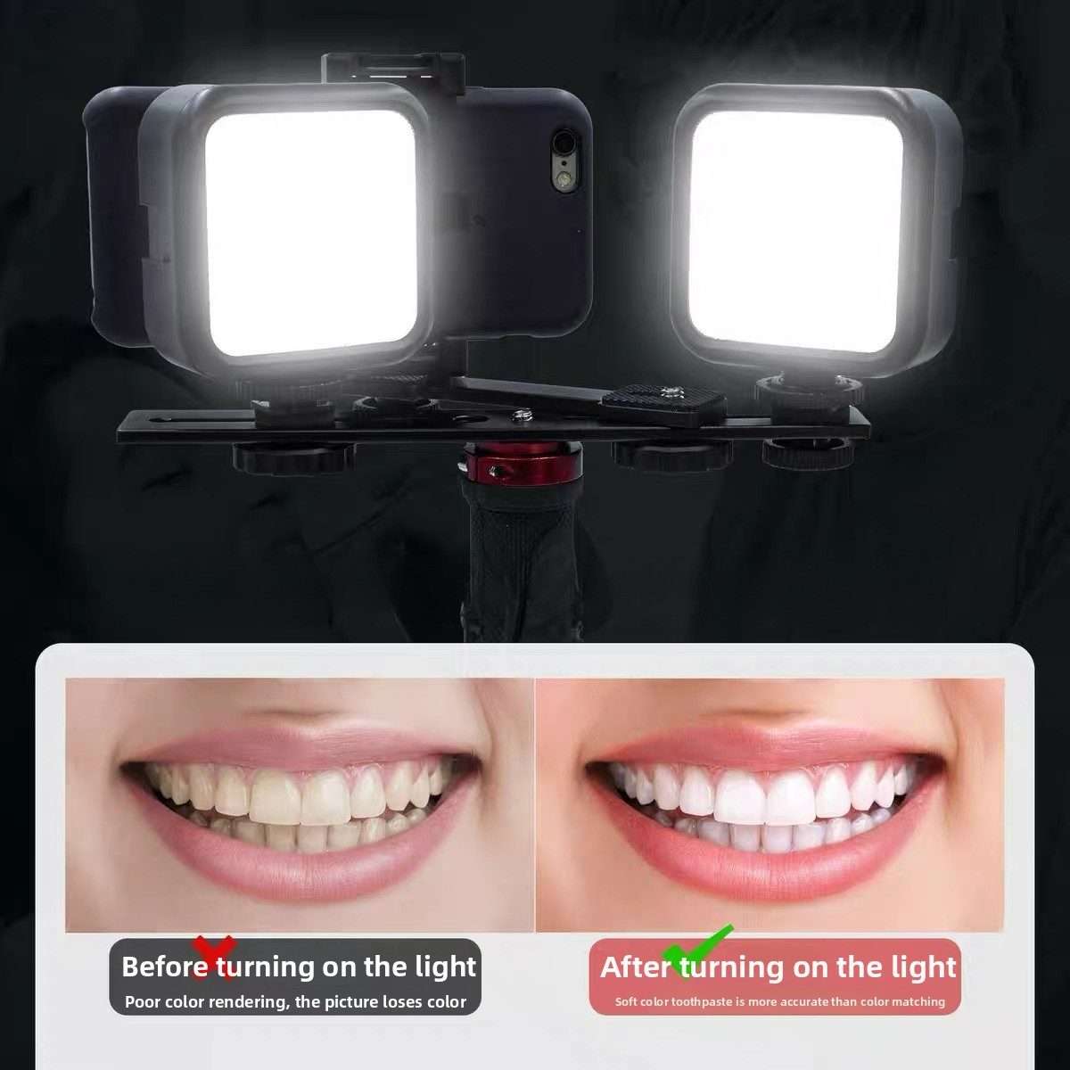 Photography Lighting Video - ไฟถ่ายภาพทางทันตกรรมพร้อมบลูทูธ ไฟส่องสว่างสำหรับถ่ายภาพช่องปาก ไฟฉาย LED สำหรับตรวจฟัน รักษาฟัน