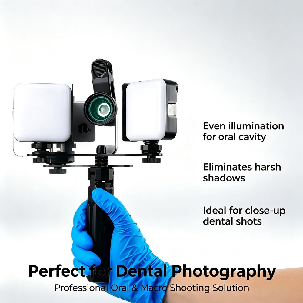 Lodden หลอดไฟเติมแสงสำหรับทันต - Macro Photography Led Lighting บทวิจารณ์และราคา